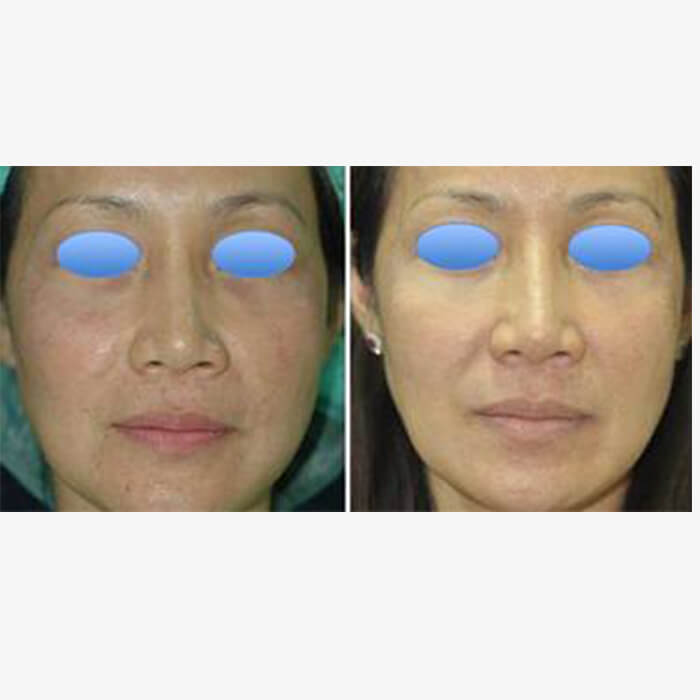 3 - Microblading Eyebrows in New York - Microblading training