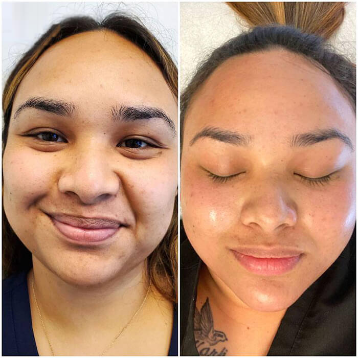 IMG_1561 - Microblading Eyebrows in New York - Microblading training