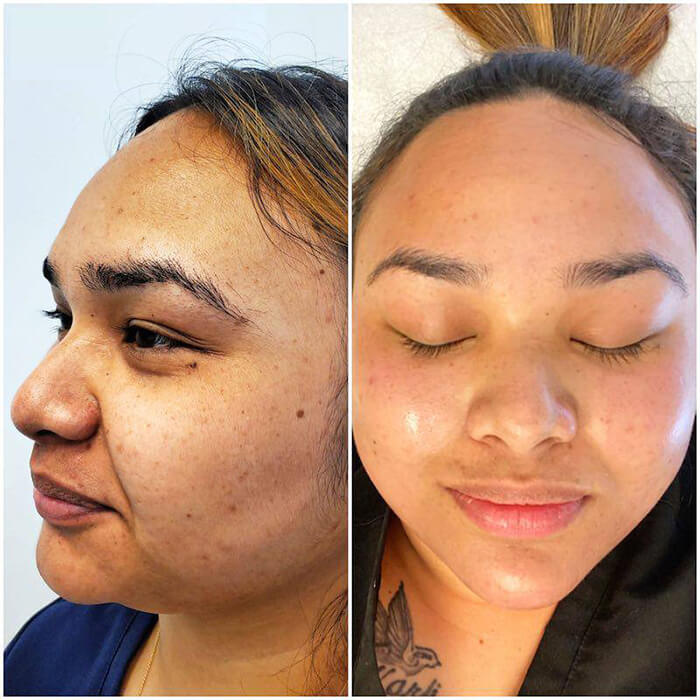 IMG_1562 - Microblading Eyebrows in New York - Microblading training