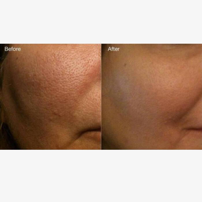 IMG_1576(1)1 - Microblading Eyebrows in New York - Microblading training
