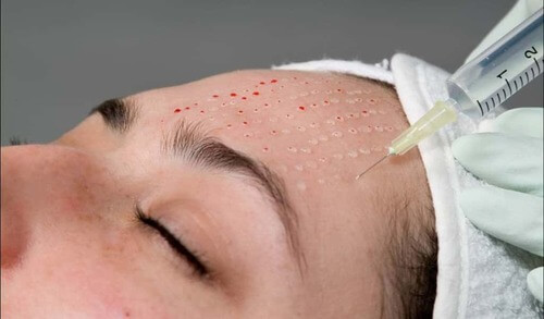 - Microblading Eyebrows in New York - Microblading training BIOREVITALIZATION NYC