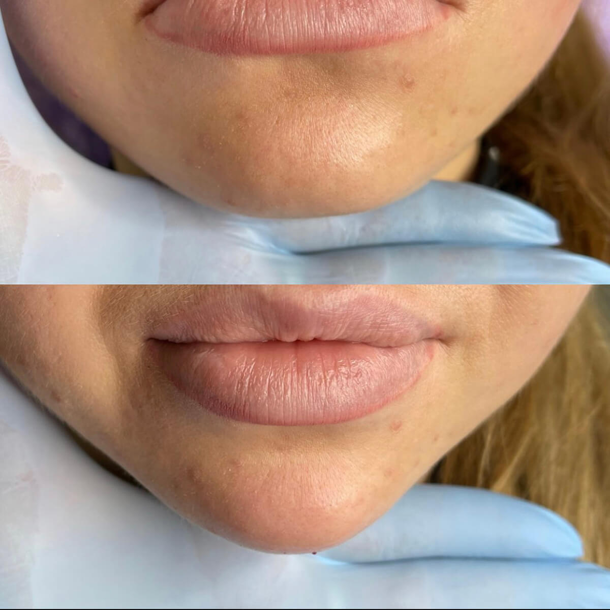 CONTOUR CORRECTION NEW YORK