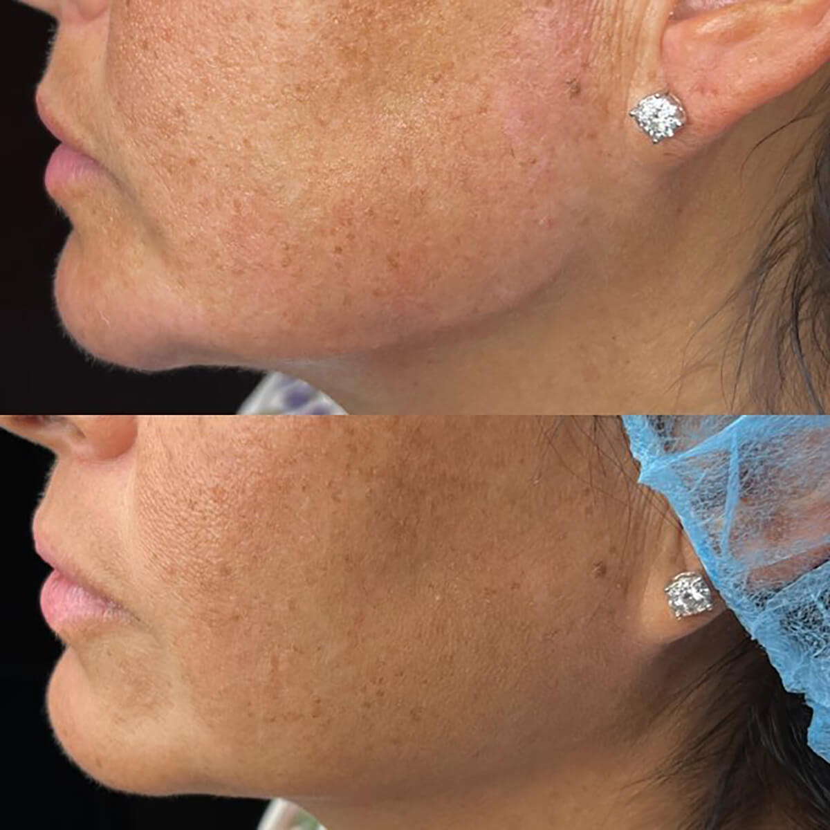 CONTOUR CORRECTION NEW YORK