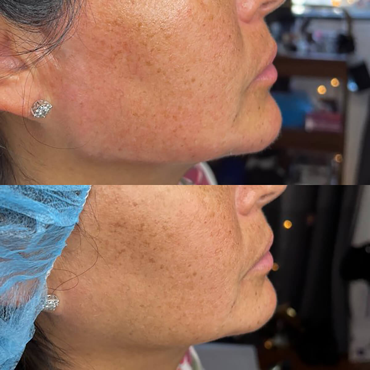 CONTOUR CORRECTION NEW YORK