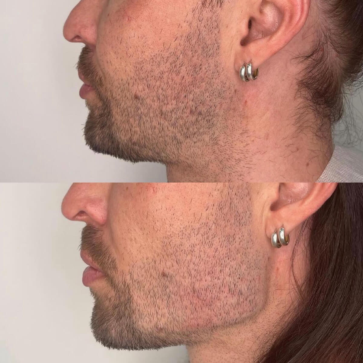 CONTOUR CORRECTION NEW YORK
