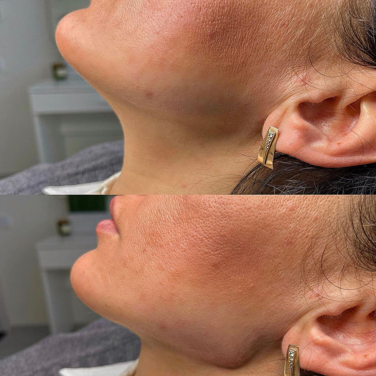 CONTOUR CORRECTION NEW YORK