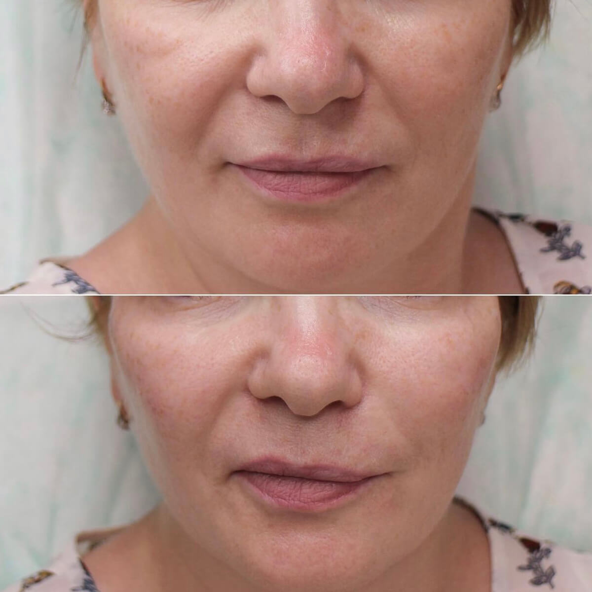 CHEEKBONE CONTOURING NYC