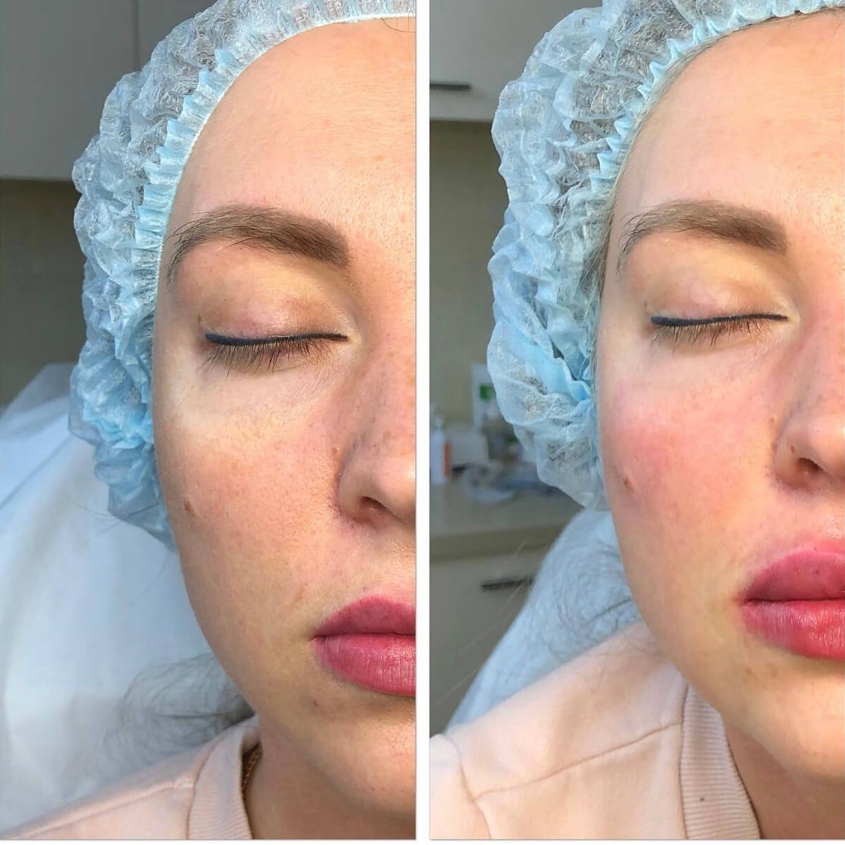 CHEEKBONE CONTOURING NYC