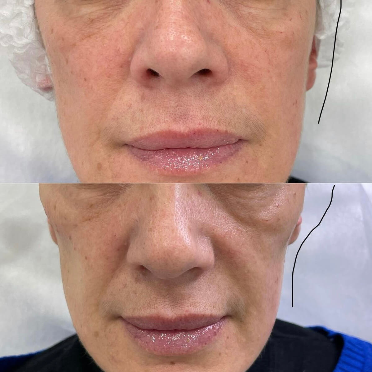 CHEEKBONE CONTOURING NYC