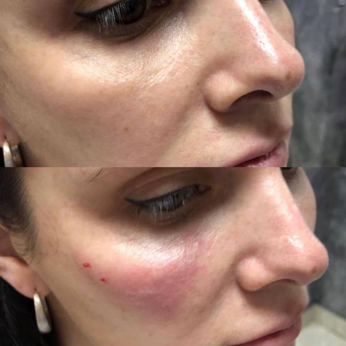 CHEEKBONE CONTOURING NYC