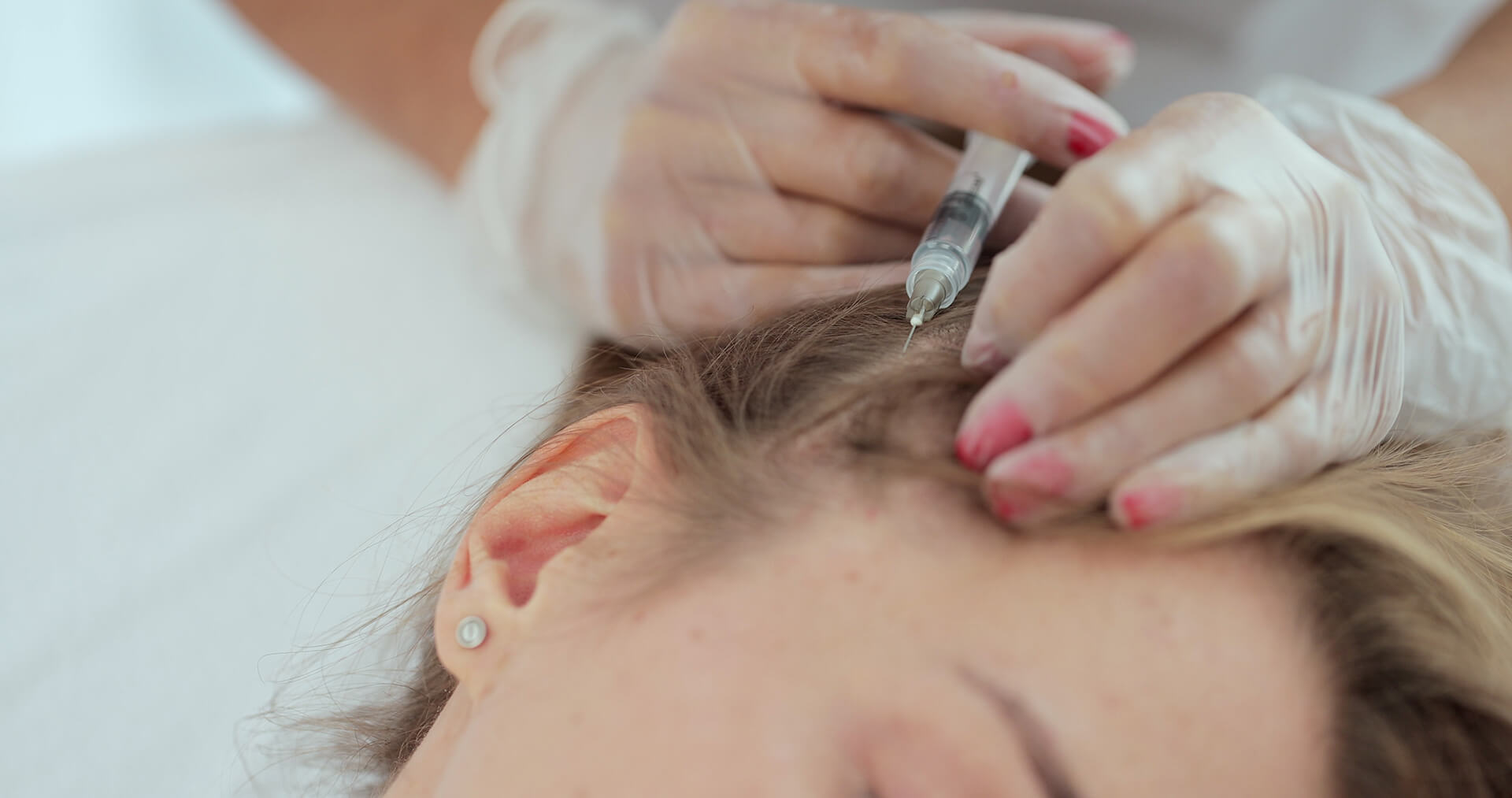 Best Mesotherapy Near Me in New York [WOWGIRLNYC®]