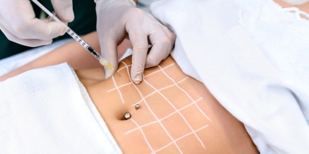 LIPOLYTIC INJECTIONS ( fat removal) NYC