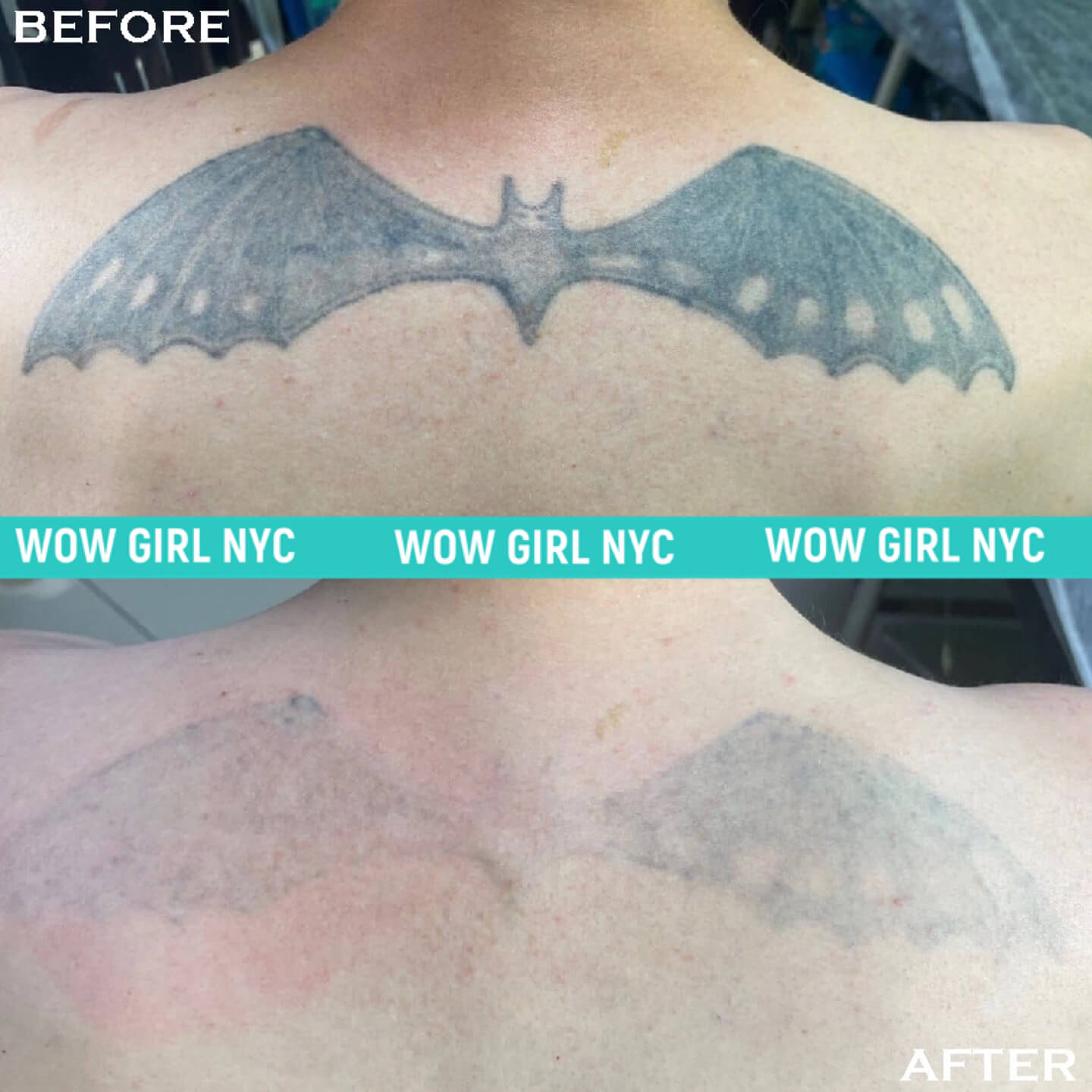 - Microblading Eyebrows in New York - Microblading training TATOO REMOVAL NEW YORK / NYC