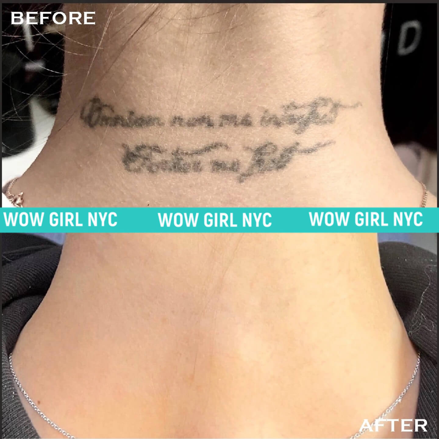 - Microblading Eyebrows in New York - Microblading training TATOO REMOVAL NEW YORK / NYC