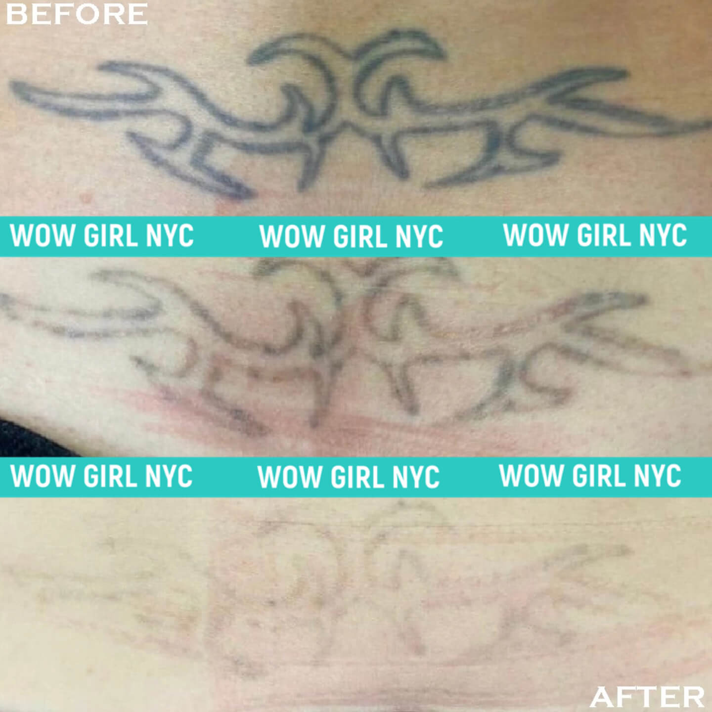 - Microblading Eyebrows in New York - Microblading training TATOO REMOVAL NEW YORK / NYC