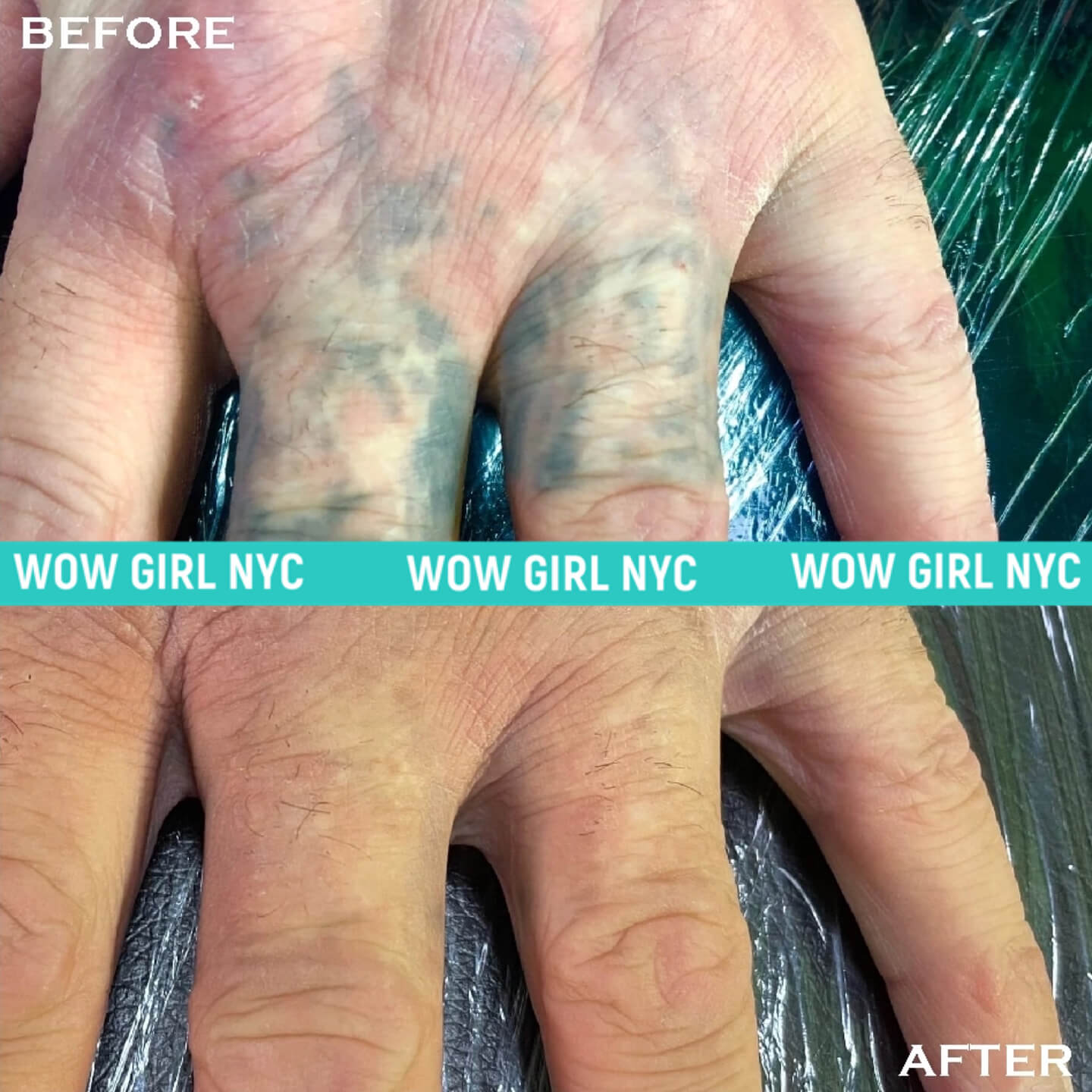 - Microblading Eyebrows in New York - Microblading training TATOO REMOVAL NEW YORK / NYC