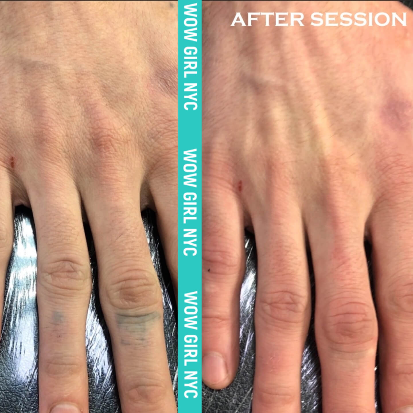 - Microblading Eyebrows in New York - Microblading training TATOO REMOVAL NEW YORK / NYC