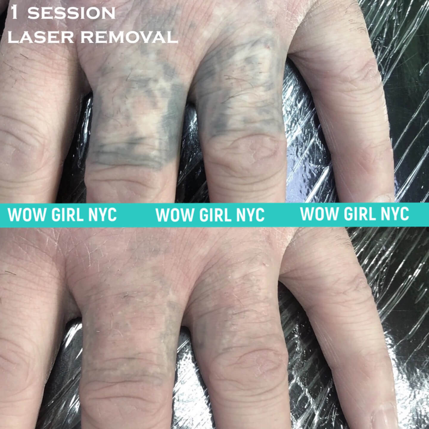 - Microblading Eyebrows in New York - Microblading training TATOO REMOVAL NEW YORK / NYC