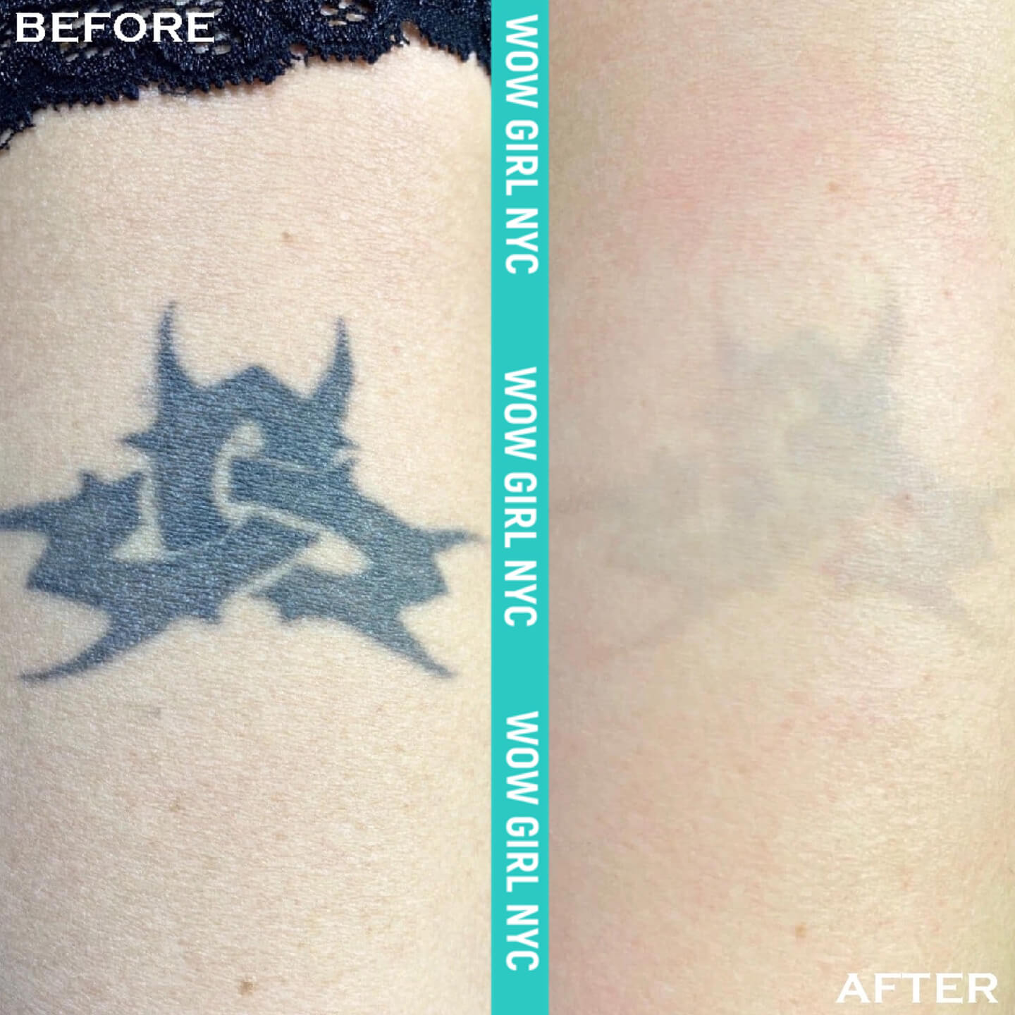 - Microblading Eyebrows in New York - Microblading training TATOO REMOVAL NEW YORK / NYC