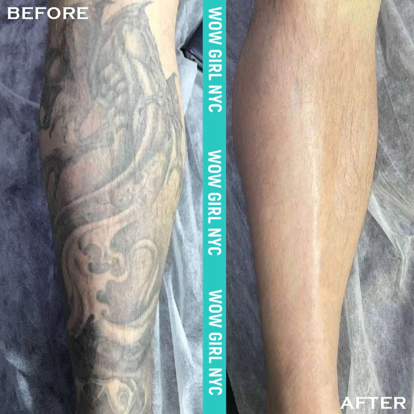- Microblading Eyebrows in New York - Microblading training TATOO REMOVAL NEW YORK / NYC