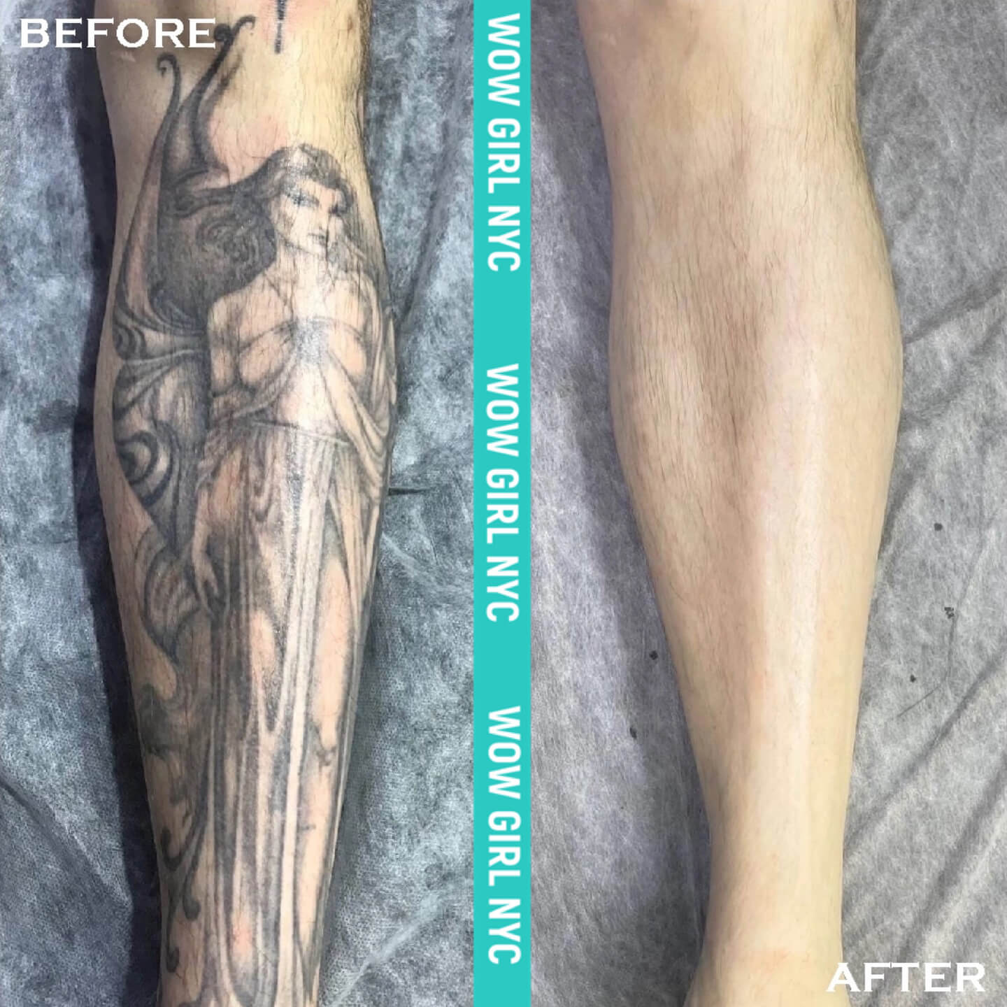 - Microblading Eyebrows in New York - Microblading training tatoo removal nyc photo