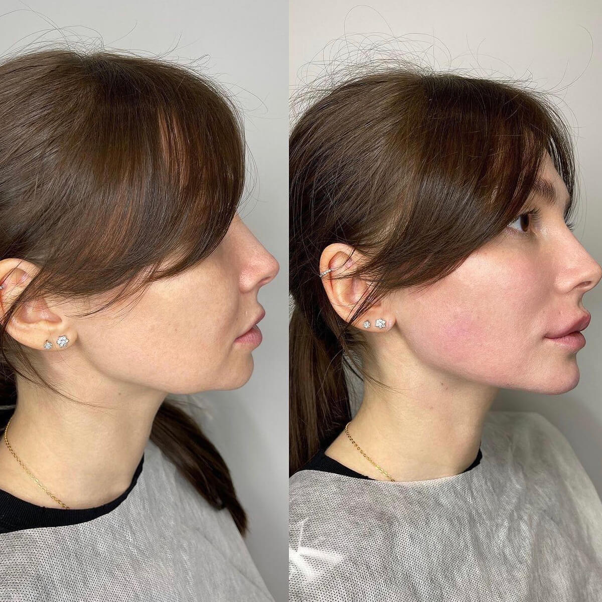 - Microblading Eyebrows in New York - Microblading training Chin and Jawline Contouring