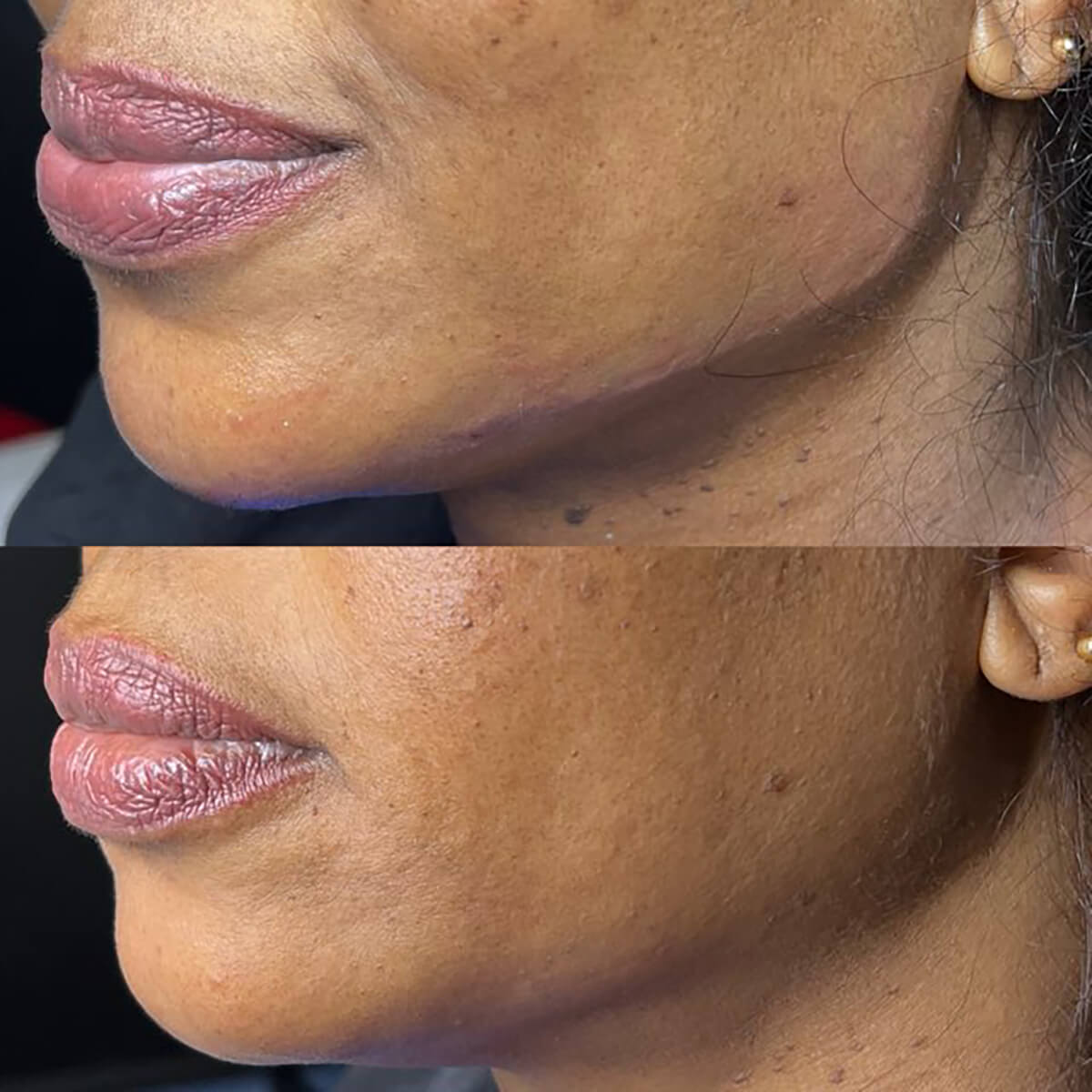 - Microblading Eyebrows in New York - Microblading training Chin and Jawline Contouring