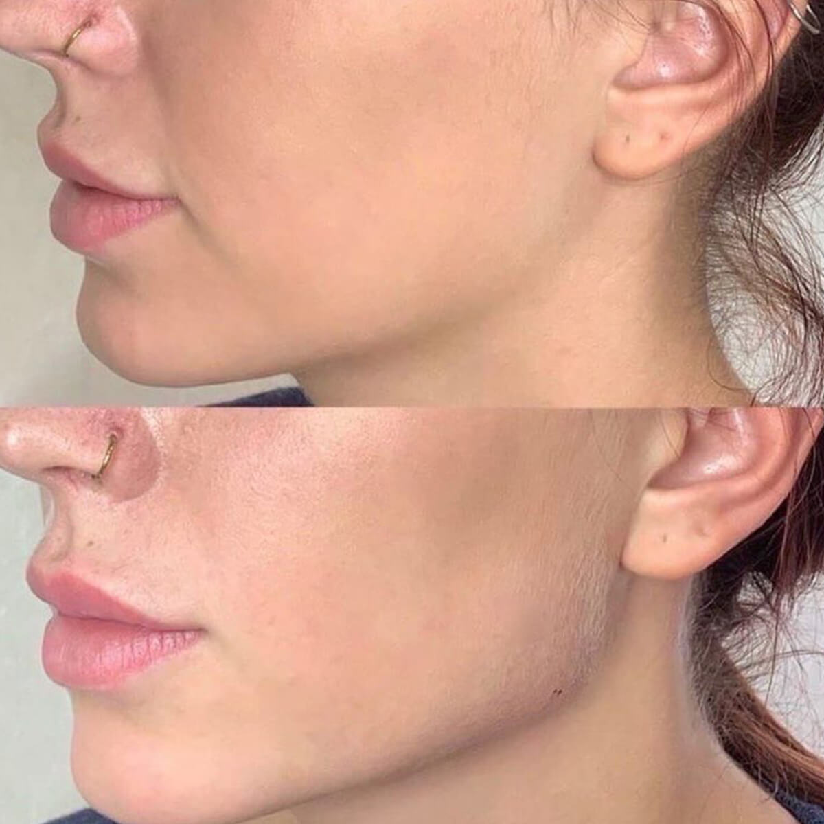 - Microblading Eyebrows in New York - Microblading training Chin and Jawline Contouring