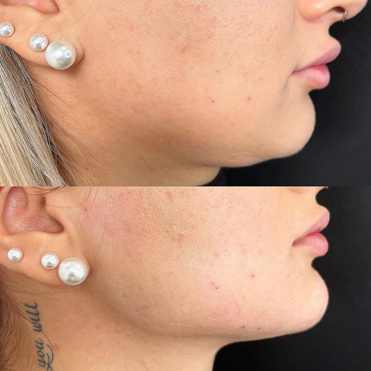 - Microblading Eyebrows in New York - Microblading training Chin and Jawline Contouring