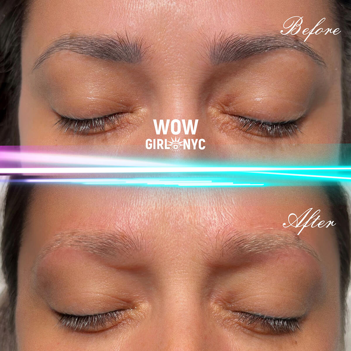 - Microblading Eyebrows in New York - Microblading training TATTOO REMOVAL EYEBROW