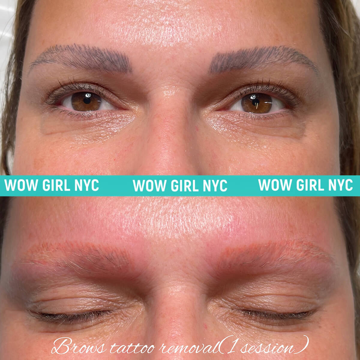 - Microblading Eyebrows in New York - Microblading training TATTOO REMOVAL EYEBROW