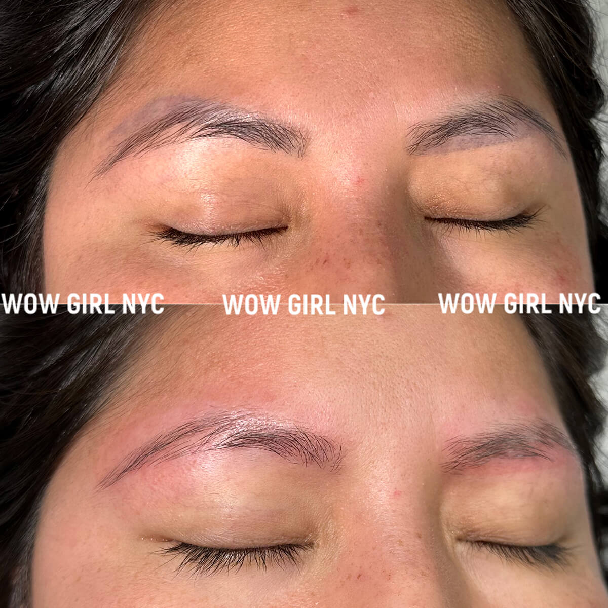 - Microblading Eyebrows in New York - Microblading training TATTOO REMOVAL EYEBROW