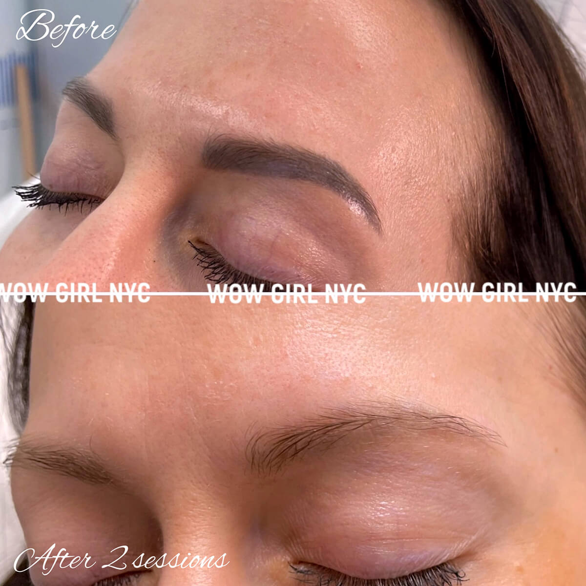- Microblading Eyebrows in New York - Microblading training TATTOO REMOVAL EYEBROW